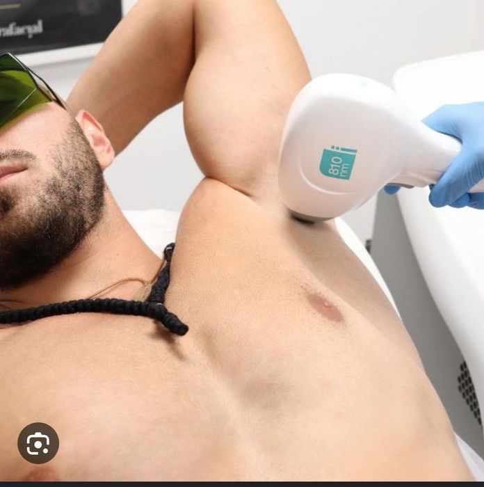 Лазерная Эпиляция для мужчин