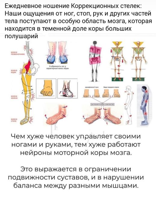 Ортопедические стельки