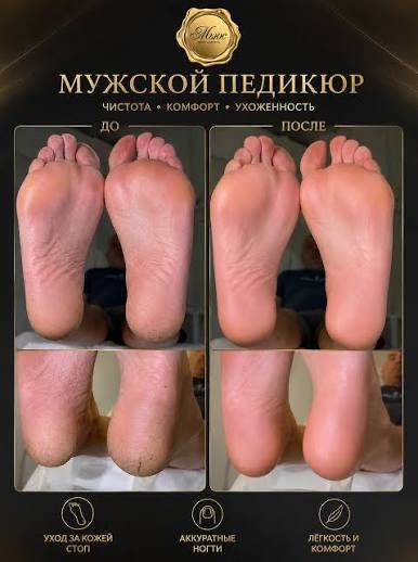 Мужской педикюр — ухоженные стопы и ногти