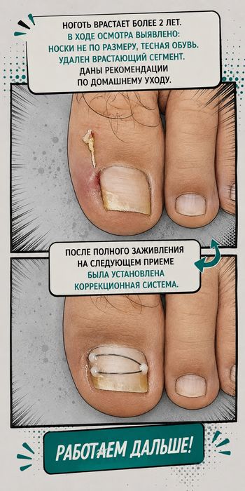 Педикюр, подолог