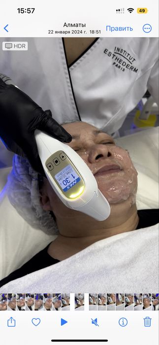 Аппарат SMAS лифтинга для косметологов