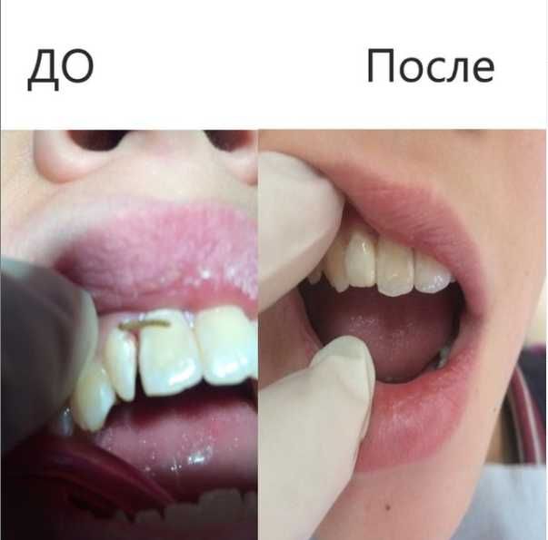 Опытный стоматолог г. Алматы