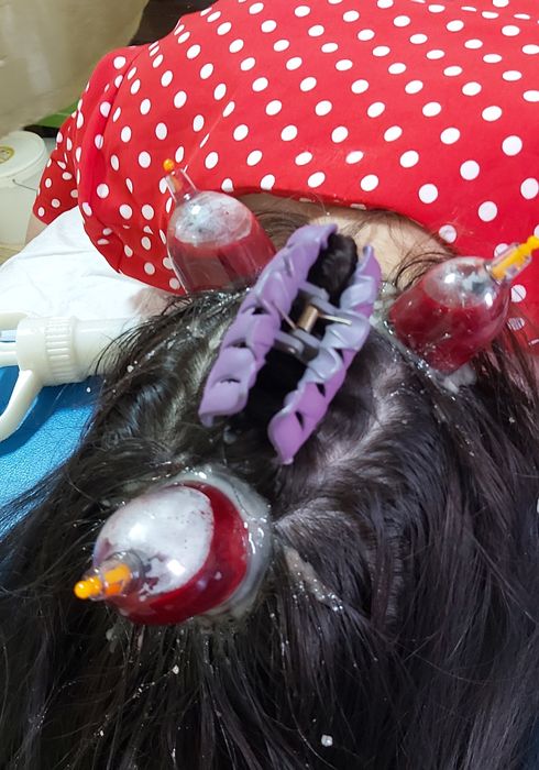 Хиджама клиникасы