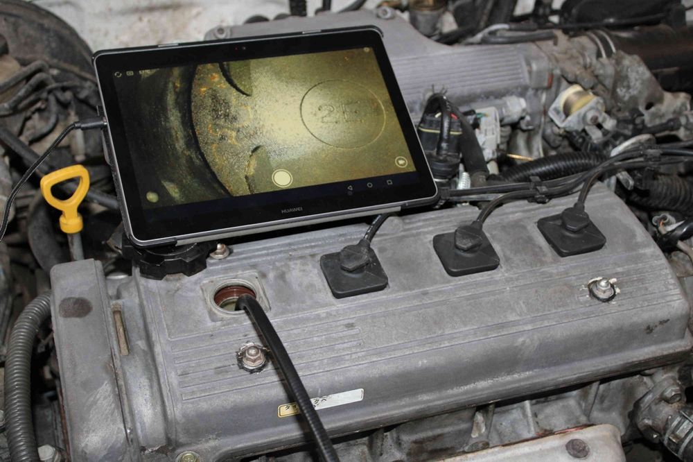 эндаскоп камера билан диагностика хизмати