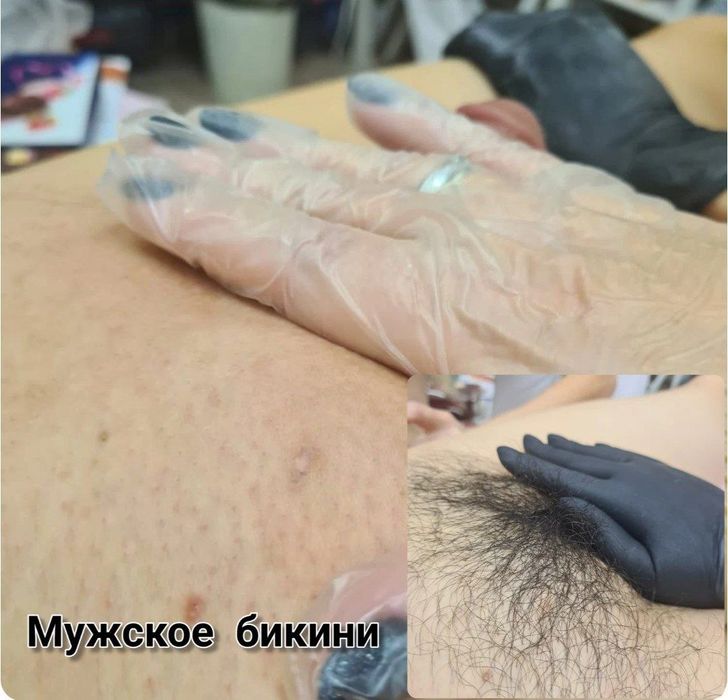 Депиляция епилатция для мужчин