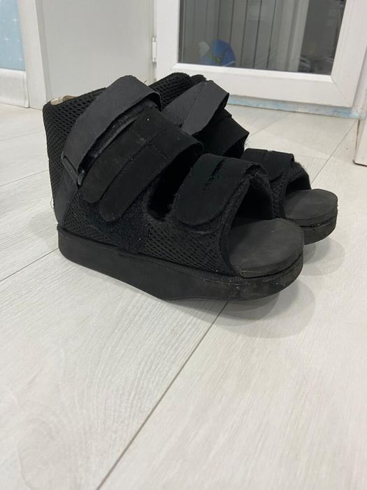 Халюс вальгус