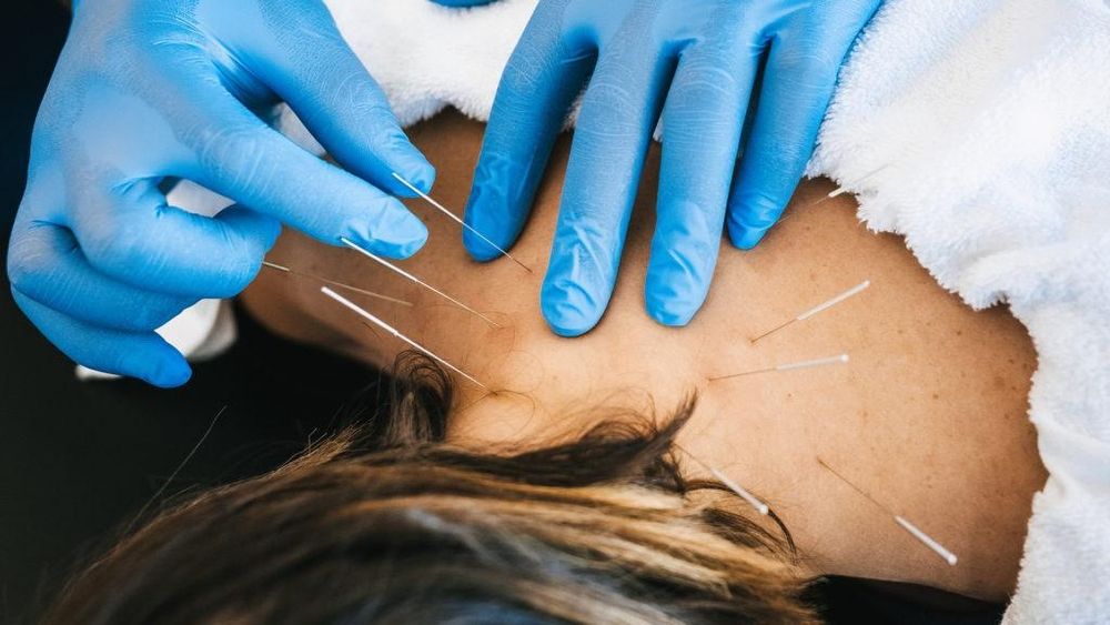 Masaj, DryNeedling , kinetoterapie la domiciliu