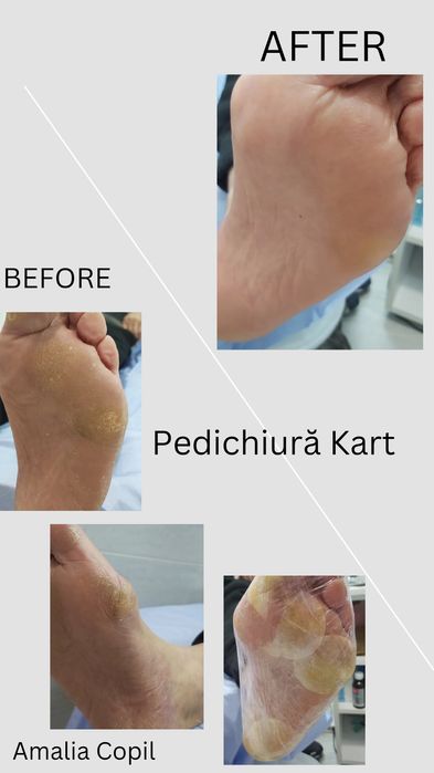 Pedichiura Kart Oradea