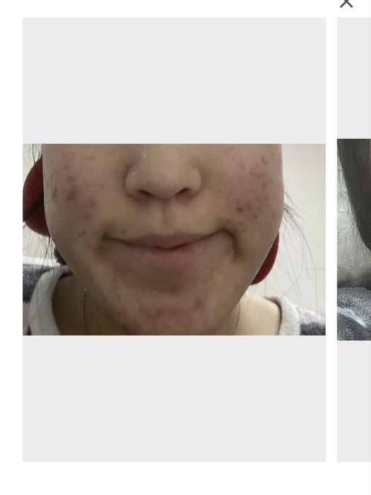 Medecassos Blemish Repair Serum — полный, без коробки