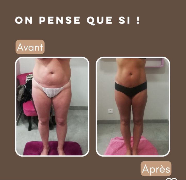 Aparatură Remodelare Starvac DXtwin Franța