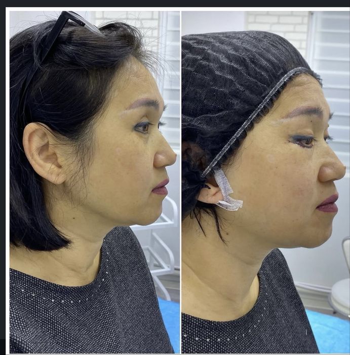 Muhabbat_cosmetolog Скидка хамма процедуралага