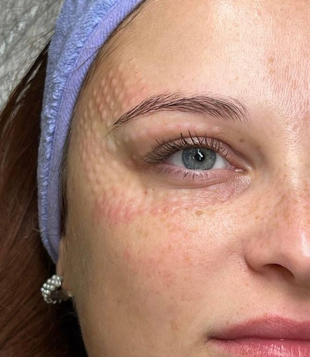 Нужна модель на косметологияческие процедуры