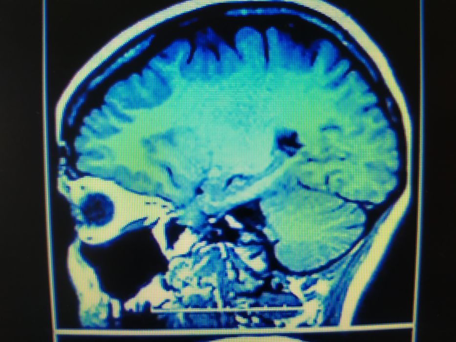 Мскт головного мозга