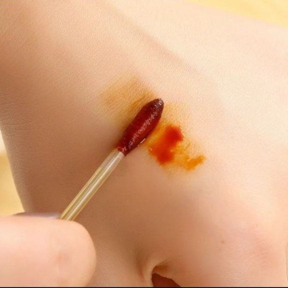 одноразовые палочки со спиртом и йодом