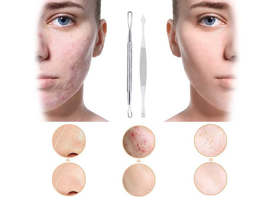 Козметичен комплект за премахване на черни точки