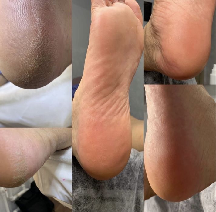 Маникюр педикюр на дом