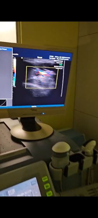 Аппарат в хорошем состоянии