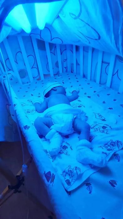 Аренда фотолампы, фотолампа, лампа от желтушки, желтуха