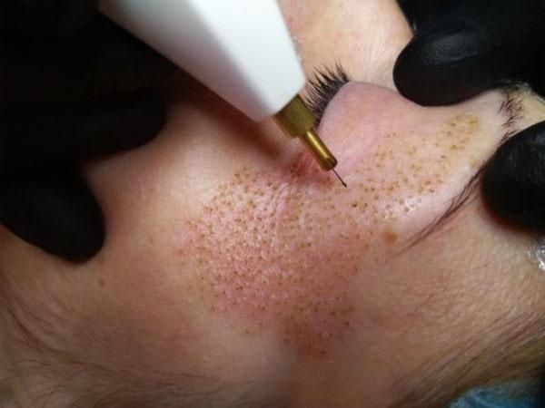 Продам плазма ручку