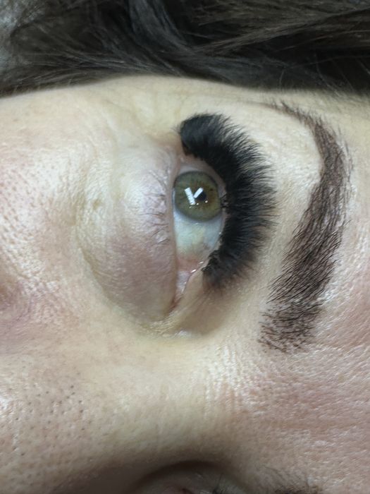 Extensii de gene- Satu Mare