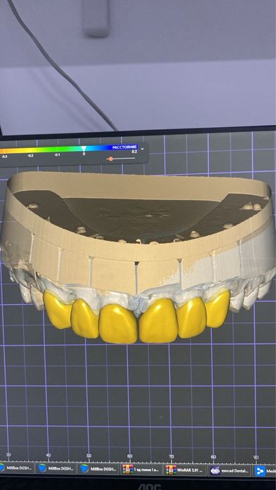 Импланты от 49.999.