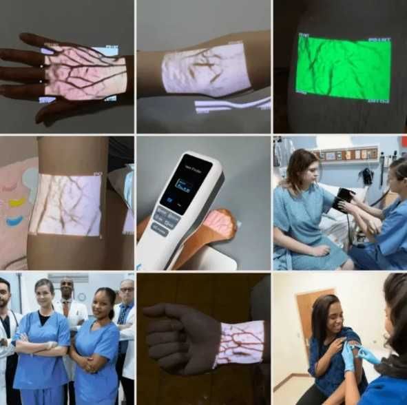 Venovizer – Vena topuvchi tibbiy qurilma | веновизор | Vein Finder