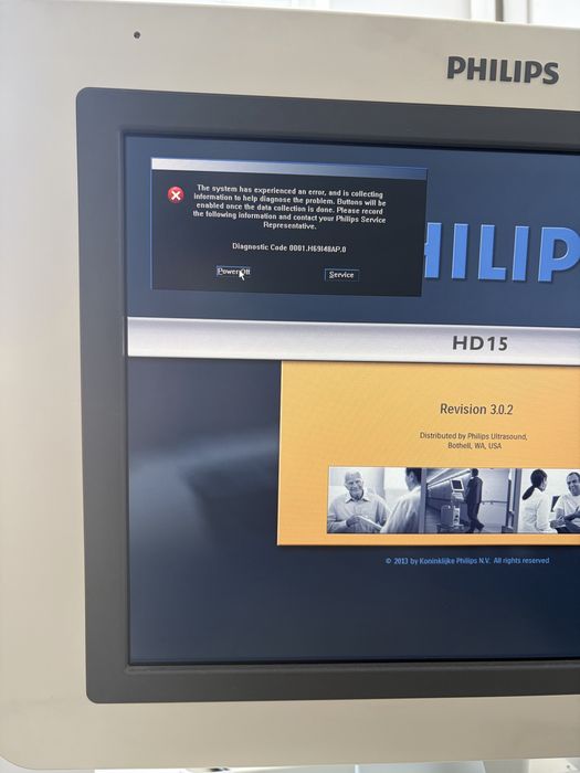 ехограф philips hd 15