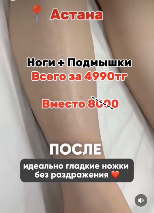 Лезерная эпиляцыя по доступным ценам, на аппарате Soprano Titanium.