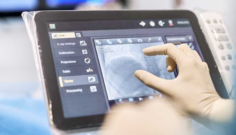 Ангиограф Philips Azurion 5 C20