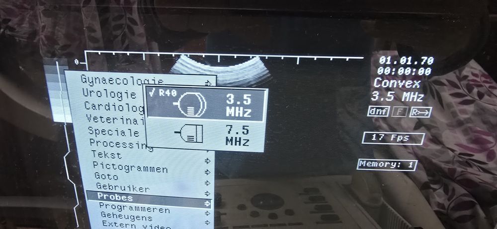 Ехогpаф Philips SDR 3250