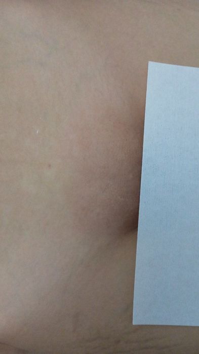 Шугаринг, депиляция