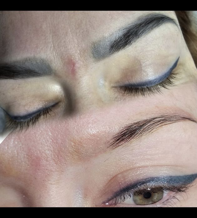 Îndepărtare tatuaj sprâncene și corp | Laser | PMU/Microblading