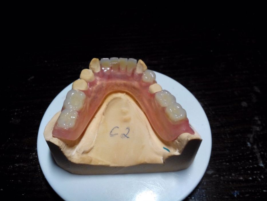 Изготавливаю сьемные протезы