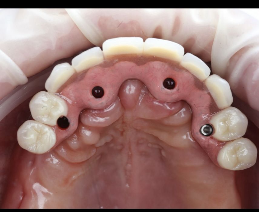 Зуботехнические услуги