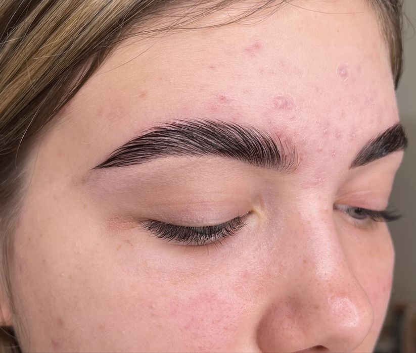 Curs laminare gene&sprancene