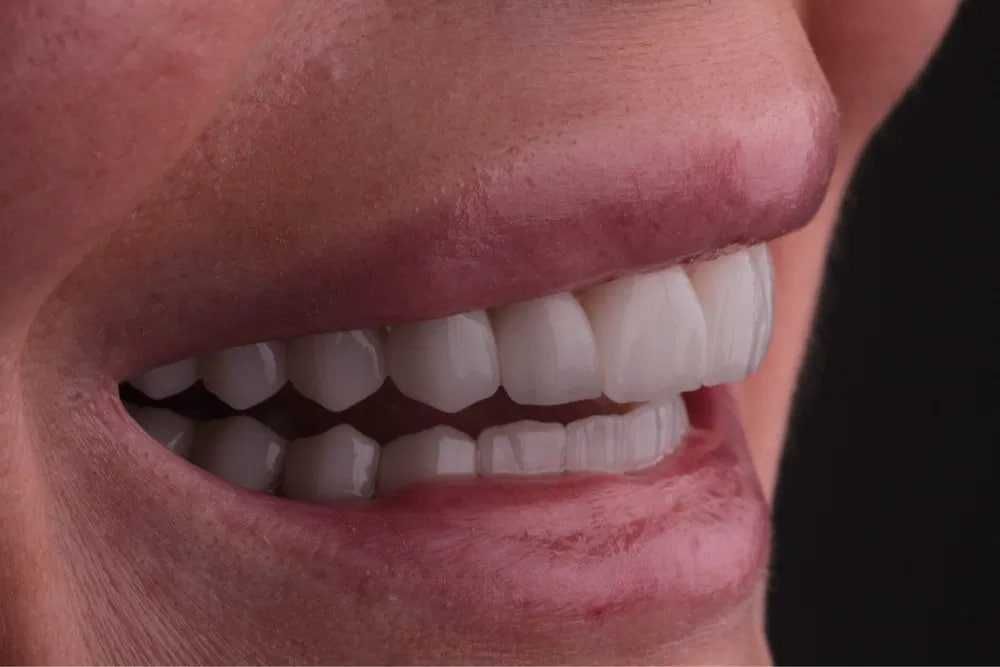 Зубного техника Cad/Cam системы в стоматологии