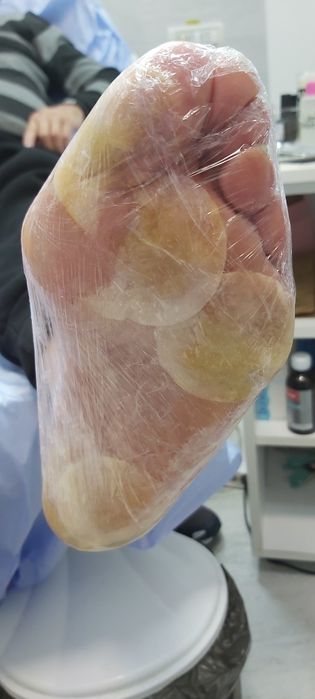 Pedichiura Kart Oradea