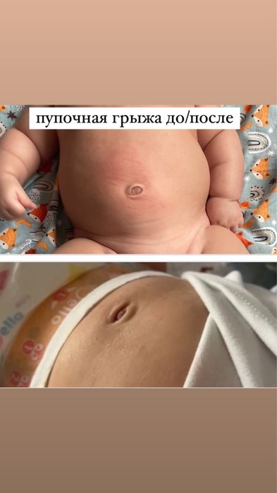 Детский массажист педиатр Алматы