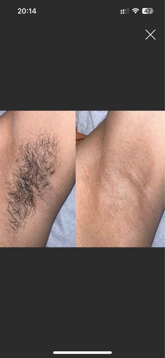 Мужской шугаринг