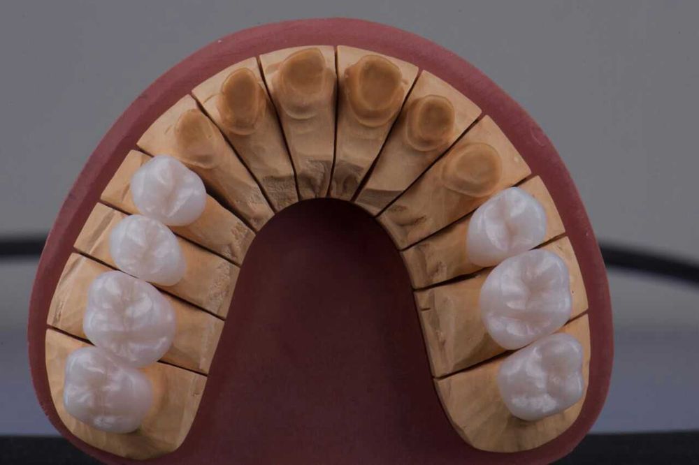 Зуботехническая Лаборатория Cad Cam ht st 4d pmma 3d shtml Протез