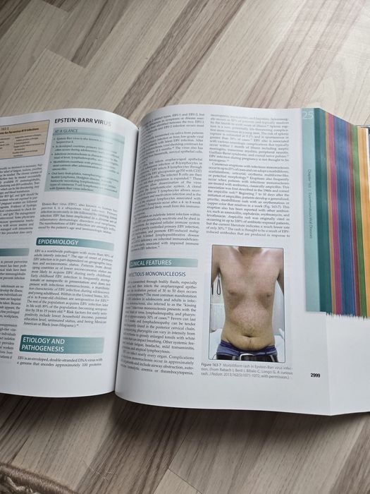 Fitzpatrick's dermatology editia 9 vol 2