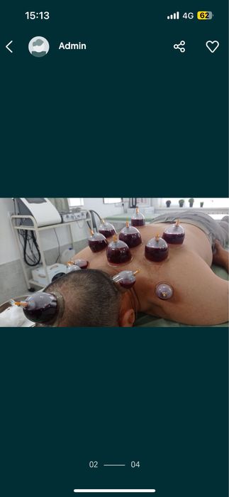 Хиджама в г.Актау