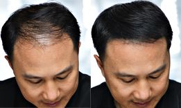 Кератинови фибри за коса | ХИТ ЦЕНА 22.00 лв. на фибри Тoppim