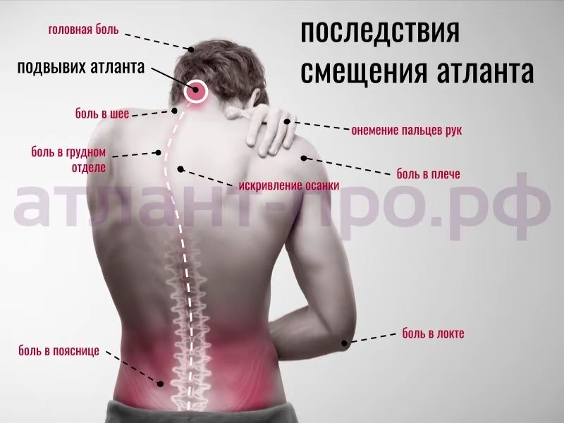 Массаж миофасциальный