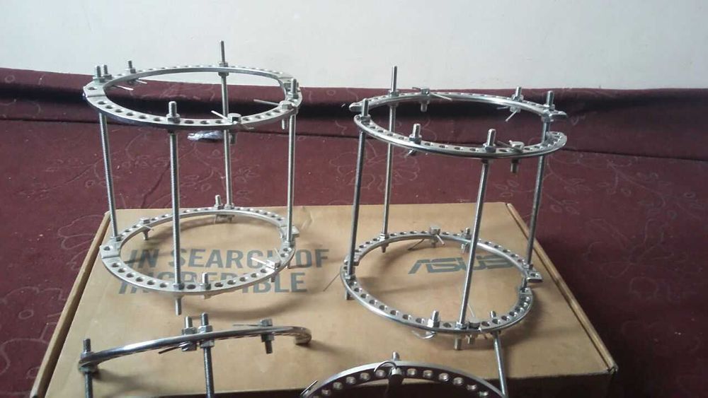 аппарат илизарова