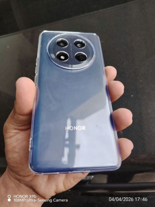 Honor x9 c ideal holatda srocna