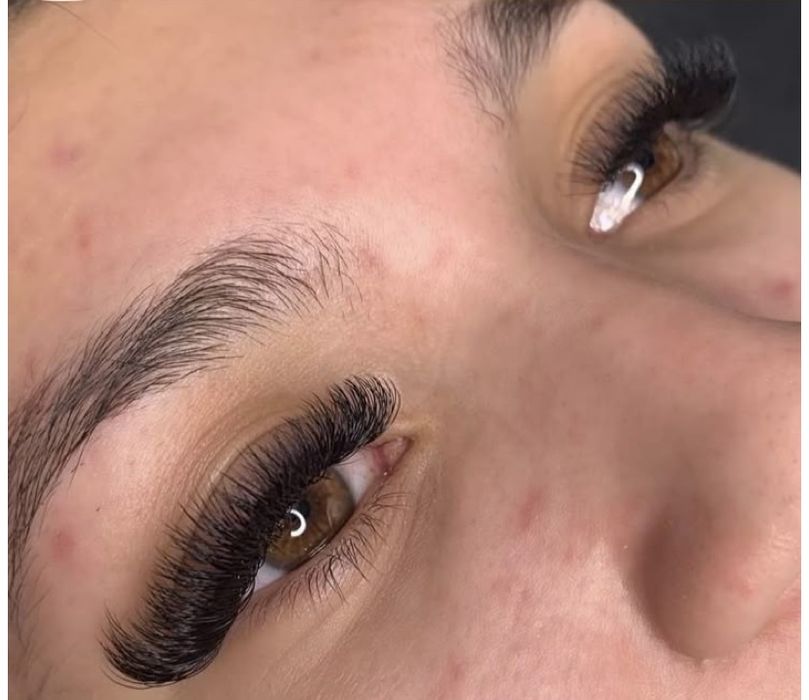 Extensii gene sector 4