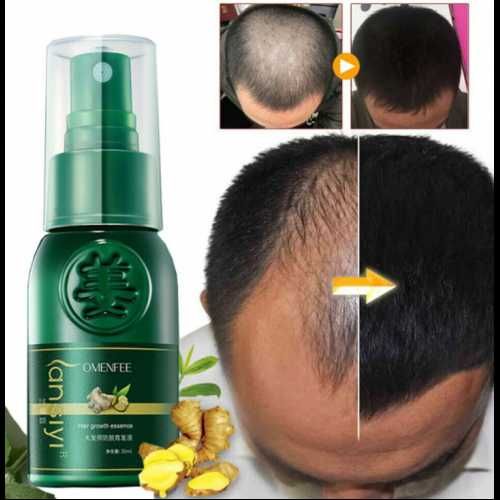 Серум спрей за по-бърз растеж на косата и против косопад