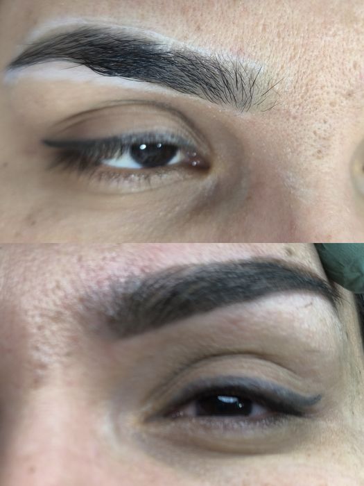 Косметолог лазеролог со стажем 10лет