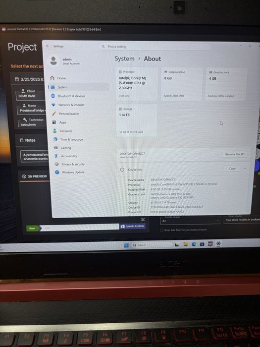 Laptop Acer cu exocad